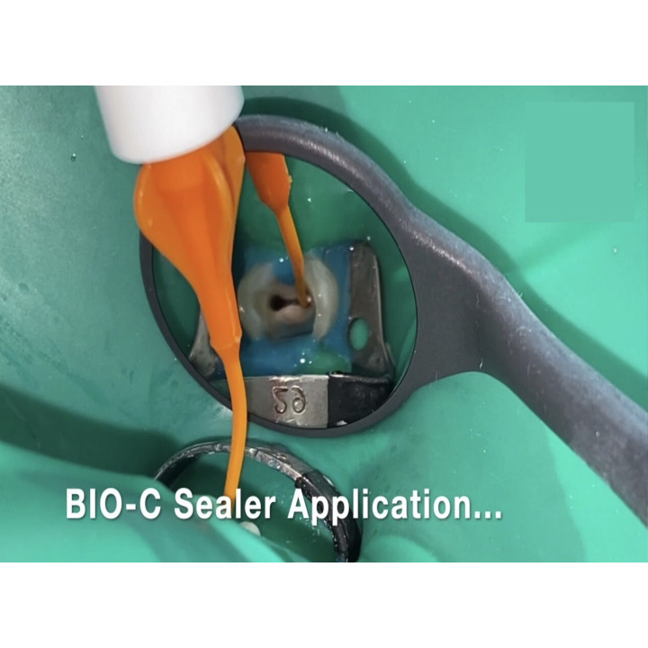 Bio-C Sealer bioceramiczny uszczelniacz kanałów korzeniowych Angelus